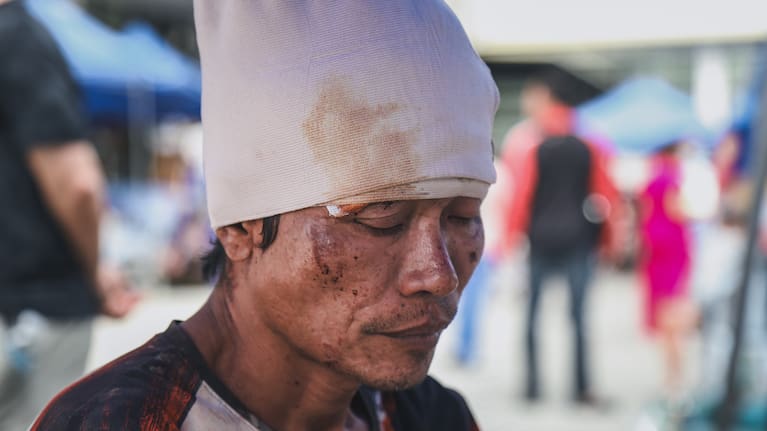 A man injured in an earthquake is seen outside the Cebu Provincial Hospital in Bogo City, Philippines