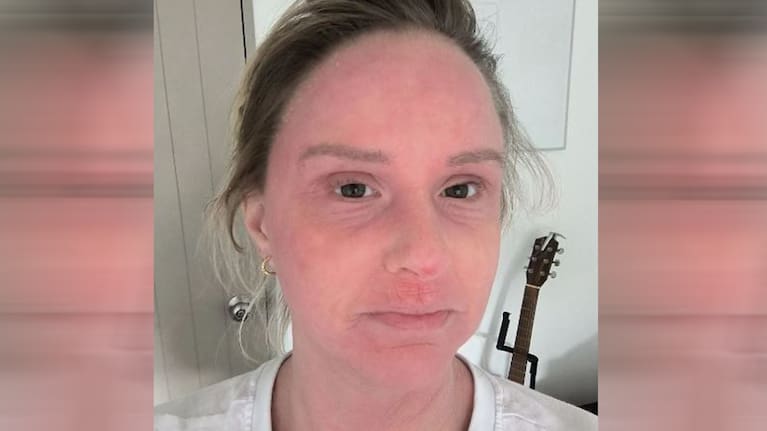 Beeby is raising money for treatment as her medical insurance doesn't cover it.