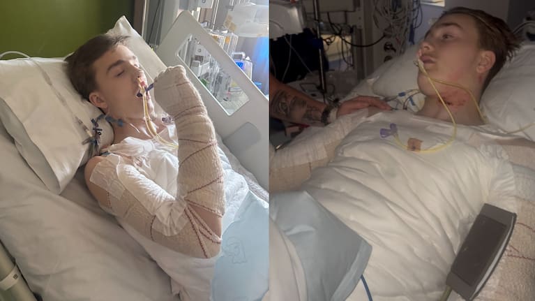 Chase Allan pictured in hospital following his accident.