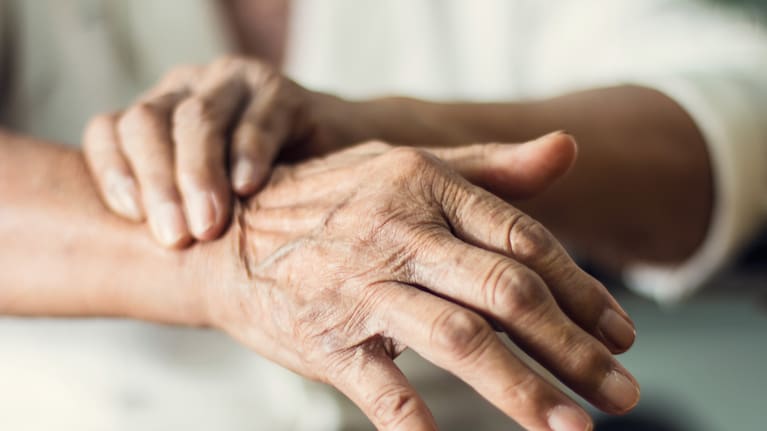 The most serious complications of osteoporosis are fractures