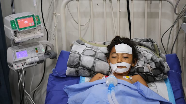 Nabila Shorbasi, who was injured by an unexploded ordnance along with her six-year-old twin brother Yahya, lies on a bed at Patient's Friends Charity Hospital in Gaza City, Saturday, October 25, 2025.
