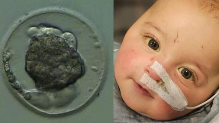 The successful thawed embryo (left) and baby Liam.