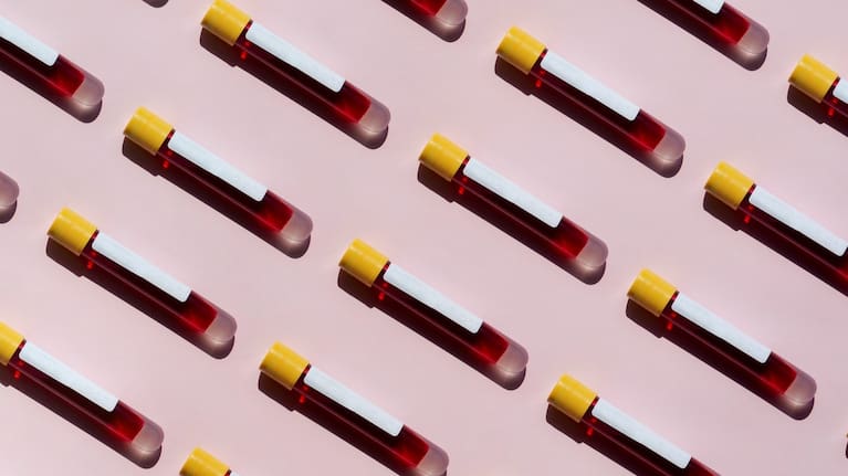 Syphilis is a sexually transmitted infection.