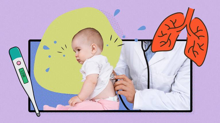A baby being checked by a doctor for whooping cough